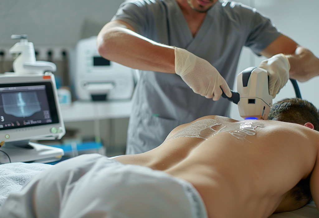laser hair removal from men's back